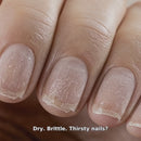 Nail Recovery